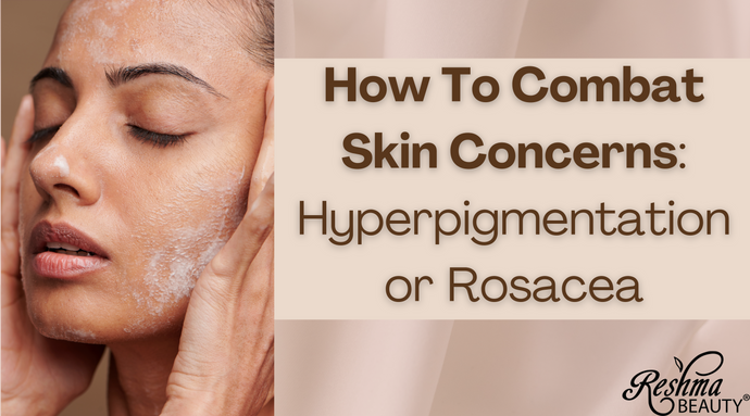 How To Combat Skin Concerns: Hyperpigmentation or Rosacea